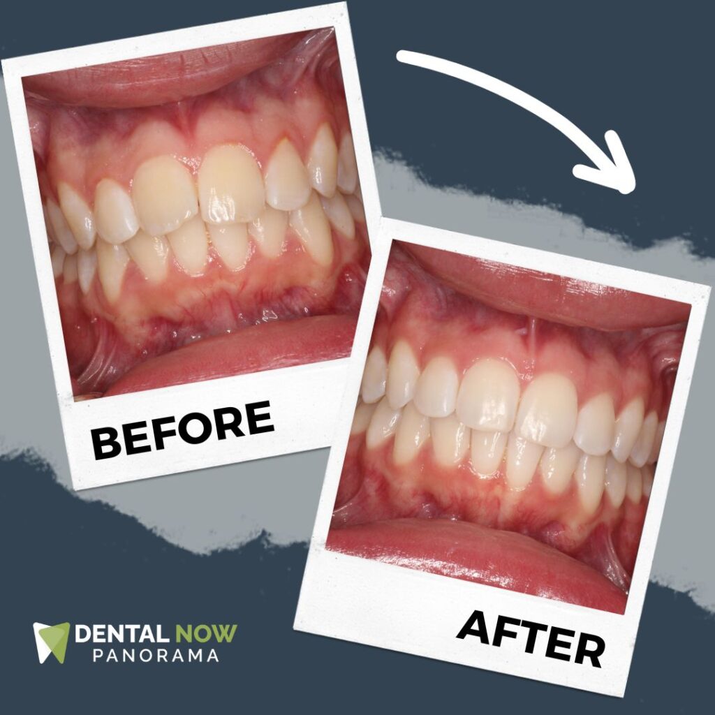 Before-and-After-Dental-Now-Panorama-10.jpg